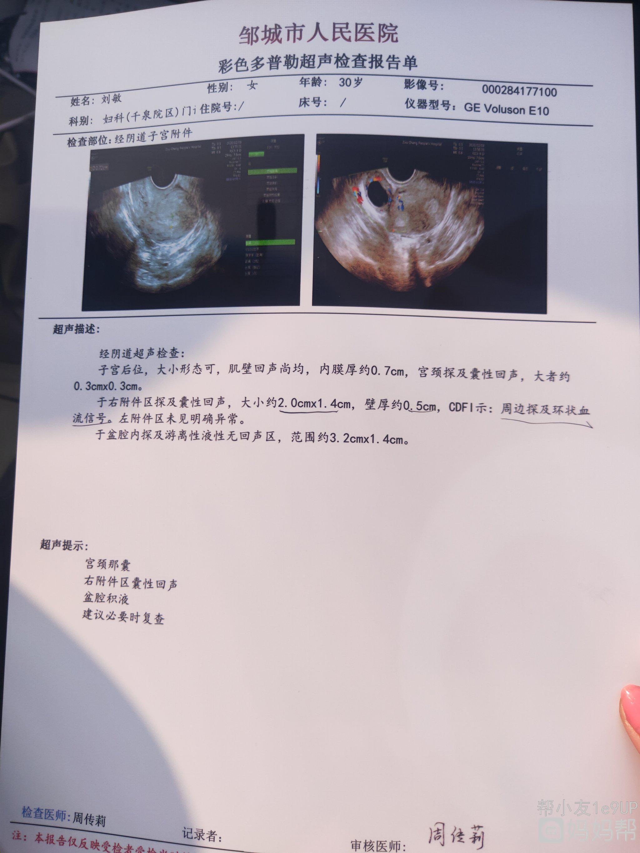 做借卵试管婴儿的全部过程是什么？胚胎培养3天和5天的区别