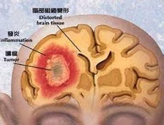 借卵试管婴儿的步骤和药物.html
