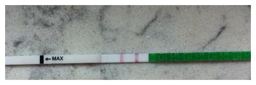 在广州，男性生殖系统疾病患者是否应在供卵做试管婴儿前接受治疗？
