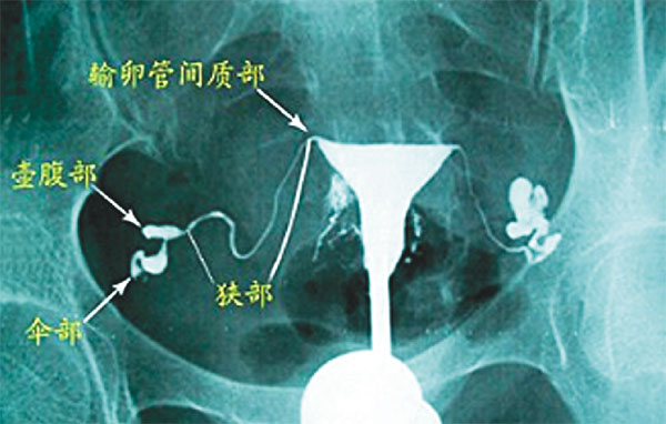 49岁月经正常能做借卵试管婴儿吗