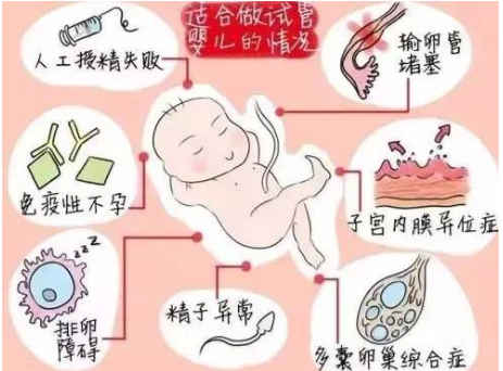 借卵试管婴儿胎盘低顺产有危险吗