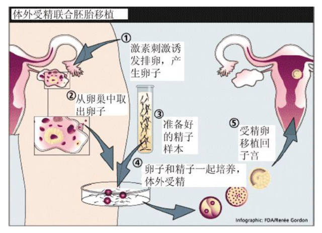 广州第三代试管代怀费用包生男孩的医院排名？何为试管代怀妈妈成功率高吗？