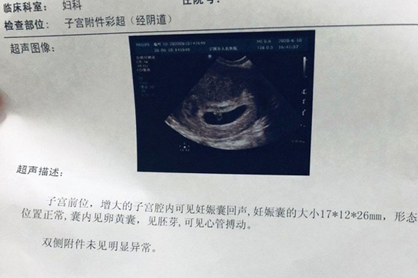 广州麟子凤雏国际助孕中心正规吗？有没有姐妹去过？